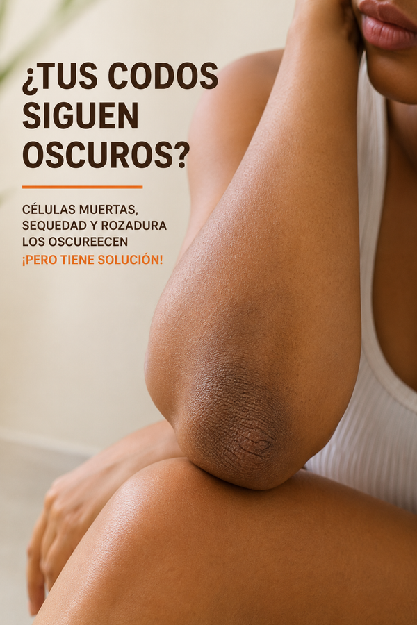 Codos y rodillas oscuros por celulas muertas acumuladas